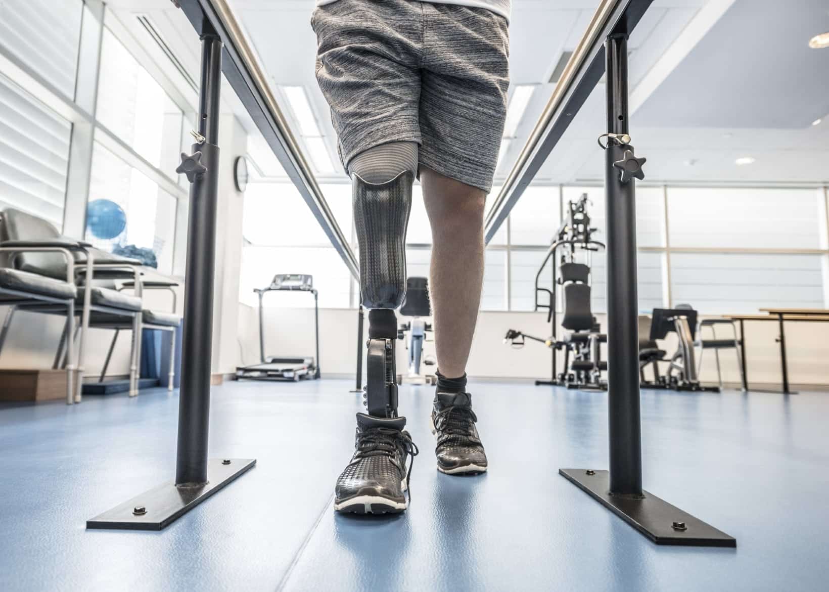 Amputee Undergoing Physical Therapy Stock Photo