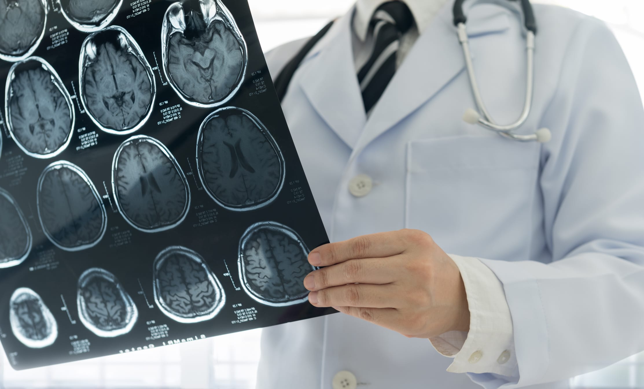 Doctor in white coat holding and examining brain MRI scans.